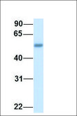 Anti-SLC29A2 antibody produced in rabbit affinity isolated antibody