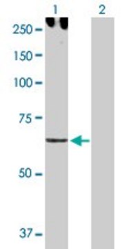 Anti-CDH6 antibody produced in rabbit purified immunoglobulin, buffered aqueous solution