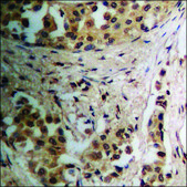 Anti-phospho-RAD52 (pTyr104) antibody produced in rabbit affinity isolated antibody