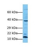 Anti-RPS15 antibody produced in rabbit affinity isolated antibody