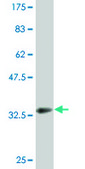 Monoclonal Anti-DECR2 antibody produced in mouse clone 4A7, purified immunoglobulin, buffered aqueous solution