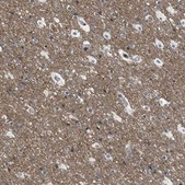 Anti-CRTC1 antibody produced in rabbit affinity isolated antibody, buffered aqueous glycerol solution