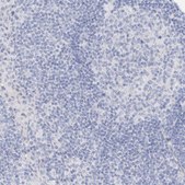 Anti-TRIM2 antibody produced in rabbit Prestige Antibodies® Powered by Atlas Antibodies, affinity isolated antibody, buffered aqueous glycerol solution