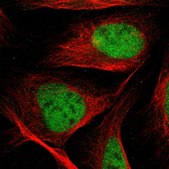 Anti-FAM208A antibody produced in rabbit Prestige Antibodies® Powered by Atlas Antibodies, affinity isolated antibody, buffered aqueous glycerol solution