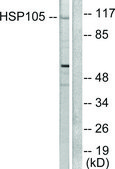 Anti-HSP105 antibody produced in rabbit affinity isolated antibody