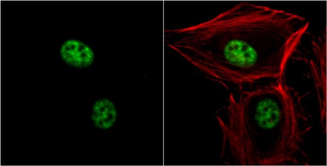 Monoclonal Anti-THOC1 antibody produced in mouse