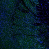 Anti-IER5 antibody produced in rabbit Prestige Antibodies® Powered by Atlas Antibodies, affinity isolated antibody, buffered aqueous glycerol solution