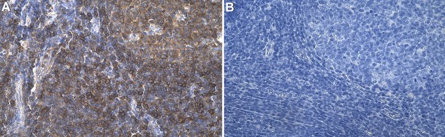 Anti-VASP Antibody, clone 1C6 ZooMAb&#174; Rabbit Monoclonal recombinant, expressed in HEK 293 cells