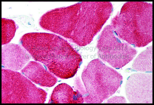 Anti-KCNJ12 antibody produced in rabbit affinity isolated antibody