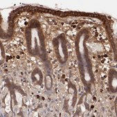 ANTI-SRRD antibody produced in rabbit Prestige Antibodies® Powered by Atlas Antibodies, affinity isolated antibody, buffered aqueous glycerol solution