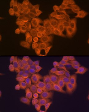 Anti-PIK3R4/VPS15 Antibody, clone 5J3U5, Rabbit Monoclonal