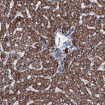 Anti-ACSS3 antibody produced in rabbit Prestige Antibodies&#174; Powered by Atlas Antibodies, affinity isolated antibody, buffered aqueous glycerol solution