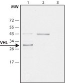Anti-VHL antibody produced in rabbit ~1.0 mg/mL, affinity isolated antibody