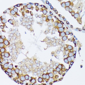 Anti-&#947;-Tubulin Antibody, clone 5R3N3, Rabbit Monoclonal