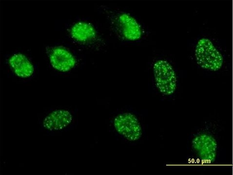 Monoclonal Anti-MSH6 antibody produced in mouse clone 1F2, purified immunoglobulin, buffered aqueous solution