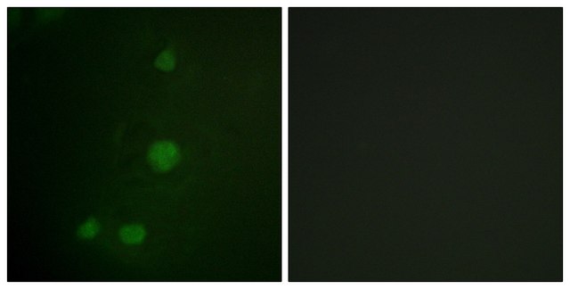 Anti-Retinoblastoma antibody produced in rabbit affinity isolated antibody