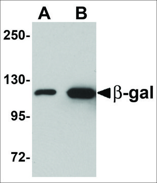 Anti-&#946;-Galactosidase antibody produced in chicken affinity isolated antibody, buffered aqueous solution