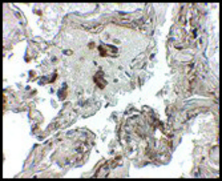 Anti-Transthyretin antibody produced in chicken affinity isolated antibody, buffered aqueous solution