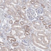 Anti-OPA1 antibody produced in rabbit Prestige Antibodies&#174; Powered by Atlas Antibodies, affinity isolated antibody, buffered aqueous glycerol solution