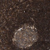 Anti-SAMD9 antibody produced in rabbit Prestige Antibodies® Powered by Atlas Antibodies, affinity isolated antibody, buffered aqueous glycerol solution, Ab2