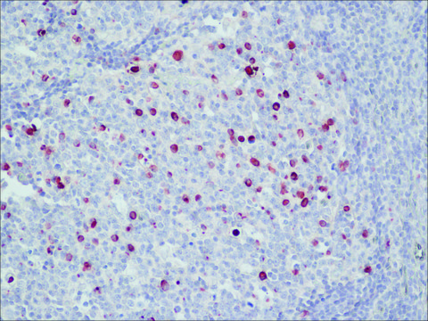 Anti-Human IgM (&#956;-chain specific)&#8722;Peroxidase antibody produced in goat affinity isolated antibody