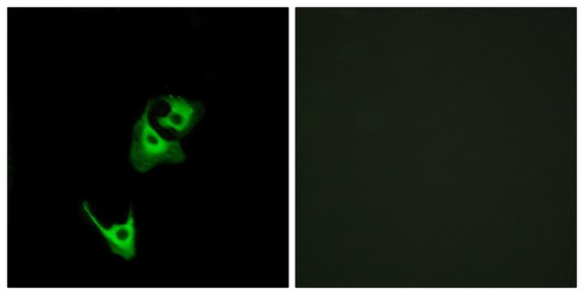 Anti-GLP1R antibody produced in rabbit affinity isolated antibody