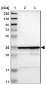 Anti-MRPL2 antibody produced in rabbit Prestige Antibodies® Powered by Atlas Antibodies, affinity isolated antibody, buffered aqueous glycerol solution