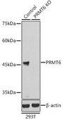 Anti- PRMT6 antibody produced in rabbit