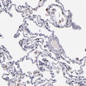 Anti-CDKL5 antibody produced in rabbit Prestige Antibodies® Powered by Atlas Antibodies, affinity isolated antibody, buffered aqueous glycerol solution