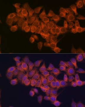 Anti-NDUFAF1 antibody produced in rabbit