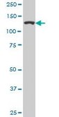 Monoclonal Anti-CAND1 antibody produced in mouse clone 1G5, purified immunoglobulin, buffered aqueous solution