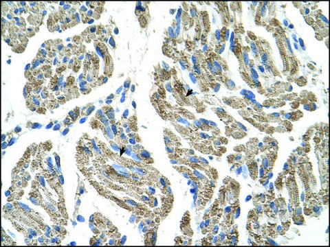 Anti-SLC25A38 antibody produced in rabbit affinity isolated antibody