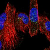 Anti-CHST11 antibody produced in rabbit Prestige Antibodies® Powered by Atlas Antibodies, affinity isolated antibody, buffered aqueous glycerol solution
