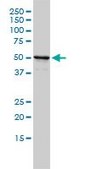 Monoclonal Anti-NPEPL1 antibody produced in mouse clone 3F8-1A6, purified immunoglobulin, buffered aqueous solution