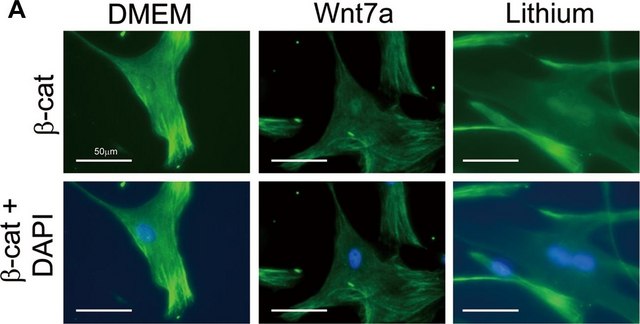 Anti-&#946;-Catenin Antibody, clone 5H10 clone 5H10, Chemicon&#174;, from mouse