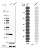Anti-LY6D antibody produced in rabbit Prestige Antibodies® Powered by Atlas Antibodies, affinity isolated antibody, buffered aqueous glycerol solution