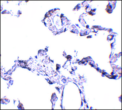 Anti-CD81 antibody produced in rabbit affinity isolated antibody, buffered aqueous solution