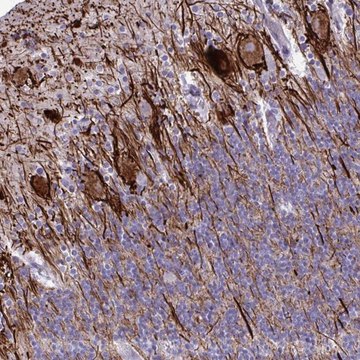 Anti-TMEM189 antibody produced in rabbit Prestige Antibodies&#174; Powered by Atlas Antibodies, affinity isolated antibody, buffered aqueous glycerol solution