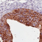 Monoclonal Anti-HER2 antibody produced in mouse Prestige Antibodies® Powered by Atlas Antibodies, clone CL0269, purified immunoglobulin, buffered aqueous glycerol solution