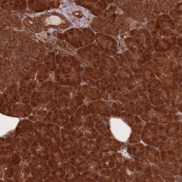 Anti-PODXL2 antibody produced in rabbit Prestige Antibodies&#174; Powered by Atlas Antibodies, affinity isolated antibody, buffered aqueous glycerol solution