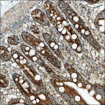 Anti-ADARB2 antibody produced in rabbit Prestige Antibodies&#174; Powered by Atlas Antibodies, affinity isolated antibody, buffered aqueous glycerol solution