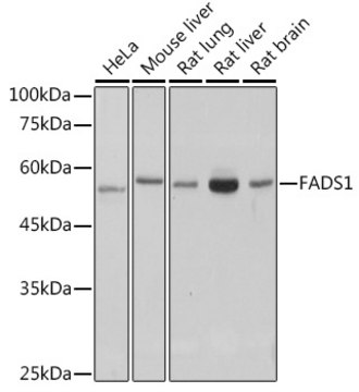 Anti-FADS1 Antibody, clone 1M8L2, Rabbit Monoclonal