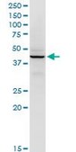 Monoclonal Anti-RFC5 antibody produced in mouse clone 1B1, purified immunoglobulin, buffered aqueous solution