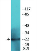 Anti-phospho-RGS16 (pTyr168) antibody produced in rabbit affinity isolated antibody