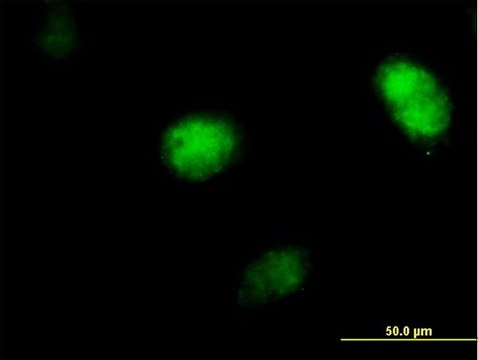 Anti-POLH antibody produced in mouse purified immunoglobulin, buffered aqueous solution