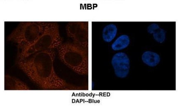 Anti-MBP antibody produced in rabbit affinity isolated antibody