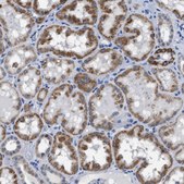 Anti-ETFA antibody produced in rabbit Prestige Antibodies® Powered by Atlas Antibodies, affinity isolated antibody, buffered aqueous glycerol solution