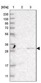 Anti-TPMT antibody produced in rabbit Prestige Antibodies® Powered by Atlas Antibodies, affinity isolated antibody, buffered aqueous glycerol solution