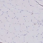 Anti-MGST1 antibody produced in rabbit Prestige Antibodies® Powered by Atlas Antibodies, affinity isolated antibody, buffered aqueous glycerol solution