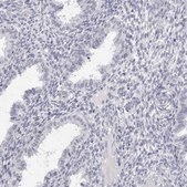 Anti-SMIM2 antibody produced in rabbit Prestige Antibodies® Powered by Atlas Antibodies, affinity isolated antibody, buffered aqueous glycerol solution
